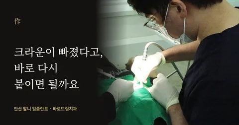 크라운·브리지가 빠졌다면, 바로 다시 붙이면 될까요