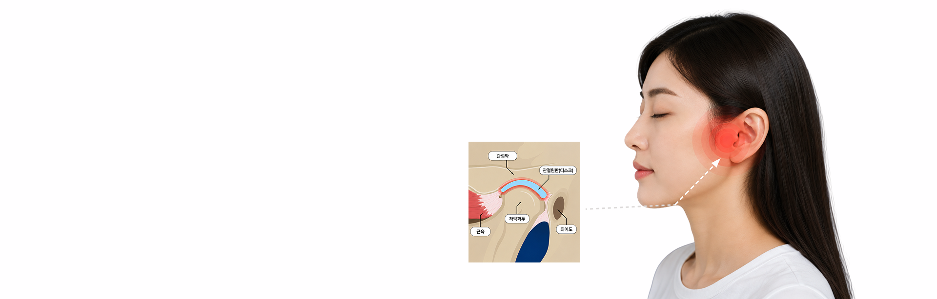 턱관절 통증 부위와 관절 구조